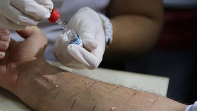Photo of غزة تحاصر مرضى السرطان بالموت.. 2000 وفاة وانهيار شبه كامل للقطاع الصحي