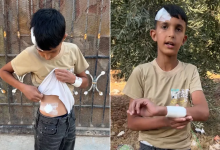 Photo of رصاص وضرب حتى الإغماء.. طفل فلسطيني يقع فريسة لوحشية الاحتلال بنابلس (شاهد)